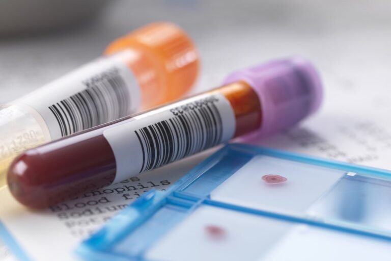 afiapro kolesterol tinggi picu stroke