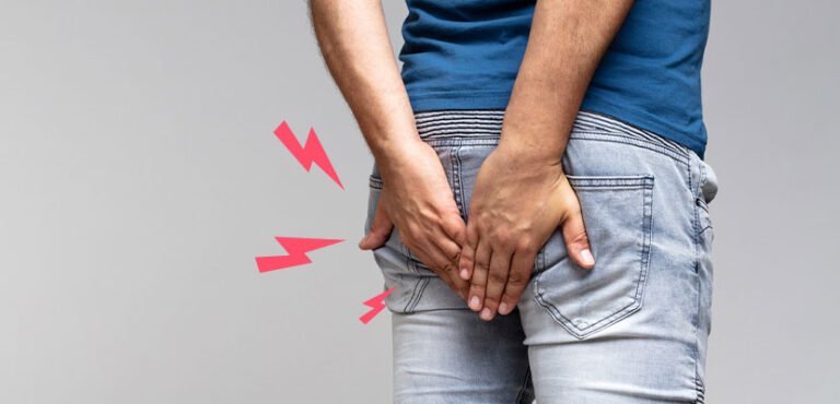 hemotera Tips Meredakan Komplikasi Wasir Ringan