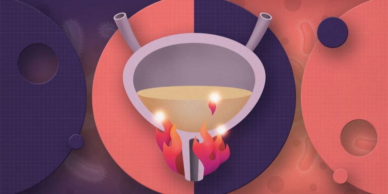 prosterafit perbedaan gejala