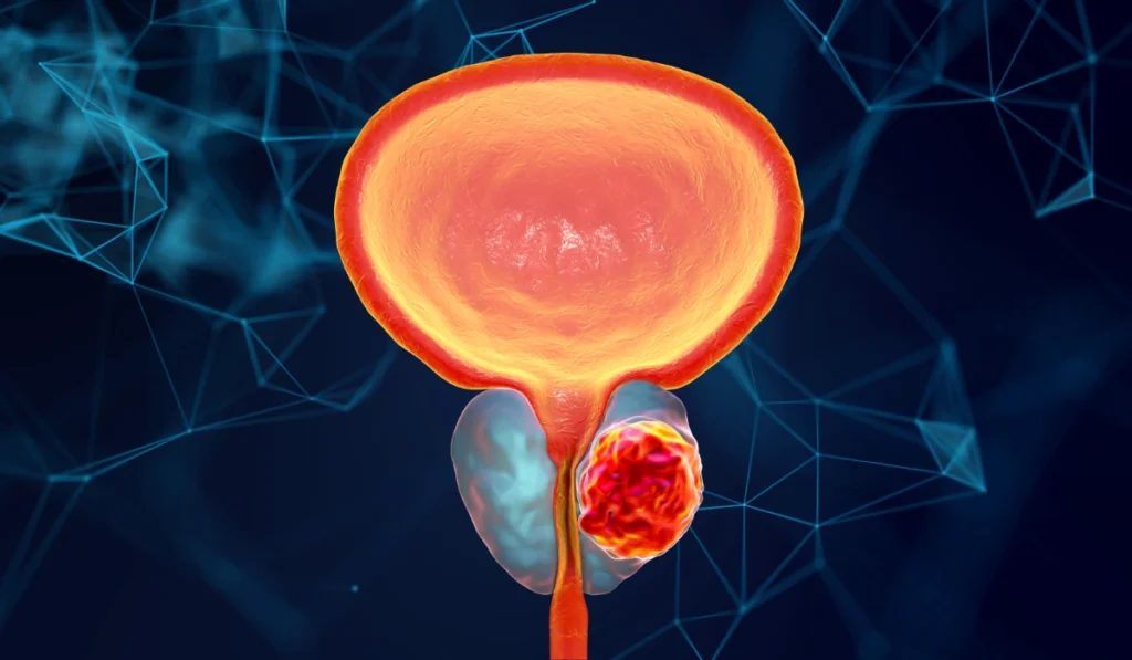 prosterafit tips kesehatan prostat pria