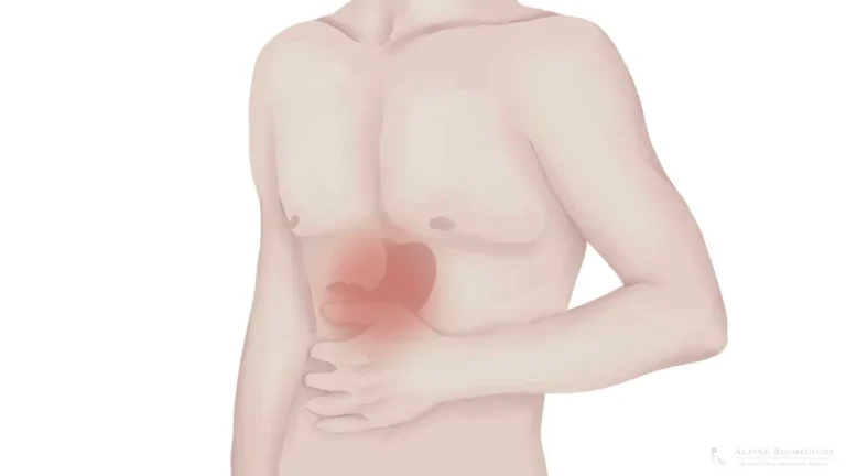 soluma penyebab infeksi lambung