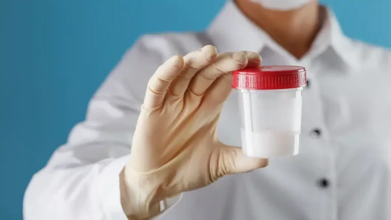 vertomen penyebab sperma kental