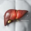 Apa Saja Penyakit pada Liver