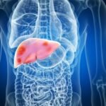 Jangan Disepelekan! Ini 5 Dampak Fatal Akibat Liver Rusak