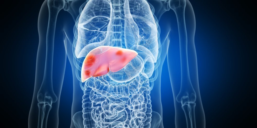 Jangan Disepelekan! Ini 5 Dampak Fatal Akibat Liver Rusak