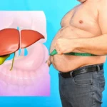 Mengapa Liver Tidak Sehat Bisa Menyebabkan Perut Buncit Berisi Cairan