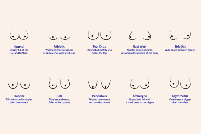 Mengenal Bentuk dan Ukuran Payudara Ideal Menurut Medis