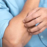 Sering Gatal-Gatal Tanpa Sebab Bisa Jadi Itu Tanda Liver Bermasalah