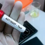 Temulawak vs Obat Kimia Mana yang Lebih Efektif Menurunkan SGPTSGOT