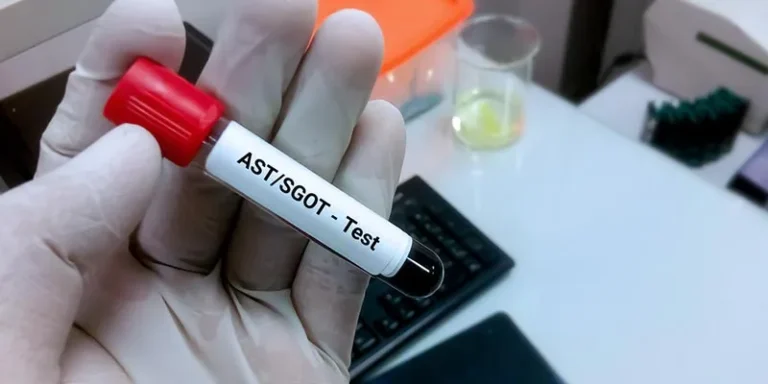 Temulawak vs Obat Kimia Mana yang Lebih Efektif Menurunkan SGPTSGOT