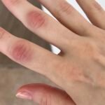 afiapro pembengkakan sendi