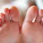 afiapro ibu jari kaki