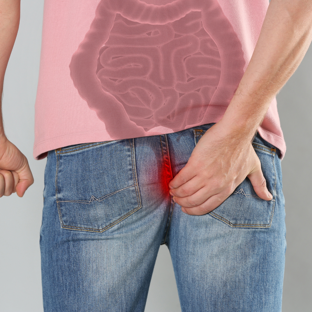 hemotera mencegah wasir secara alami