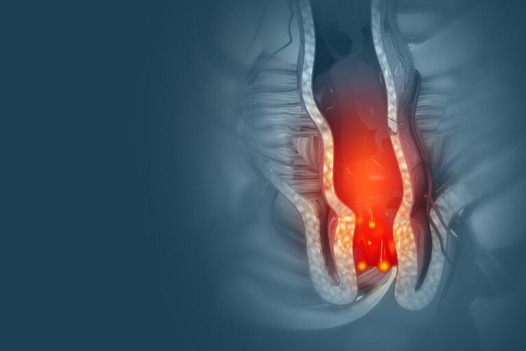 hemotera wasir lebih rentan impotensi