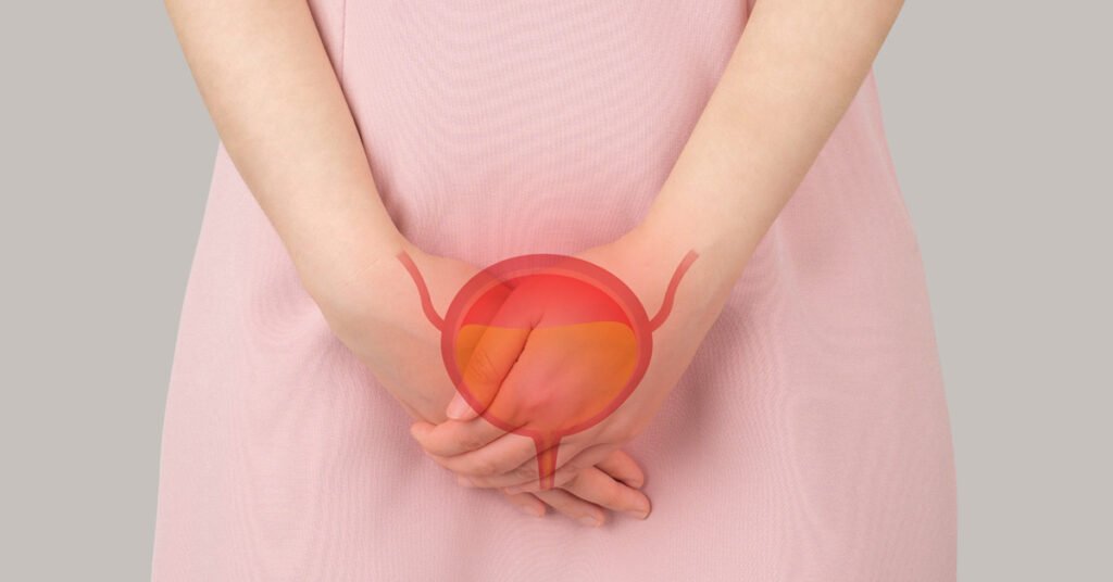 prosterafit pipis berdarah