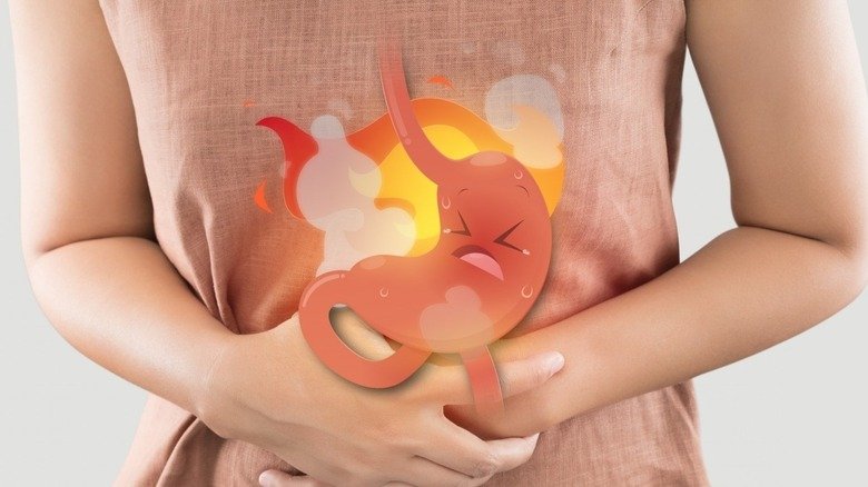 soluma komplikasi bahaya tukak lambung