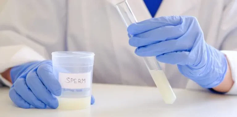 vertomen cara mencegah sperma menggumpal