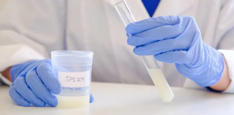 vertomen cara mencegah sperma menggumpal