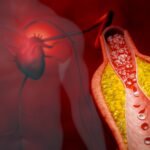 4 Alasan Mengapa Hipertensi Berbahaya bagi Jantung