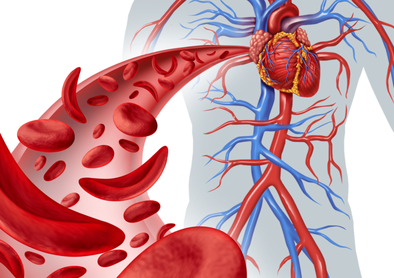 5 Cara Efektif Mengembalikan Elastisitas Pembuluh Darah Penderita Hipertensi