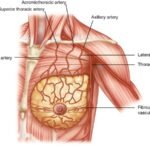Apa Faktor Utama Penyebab Perubahan Bentuk Payudara