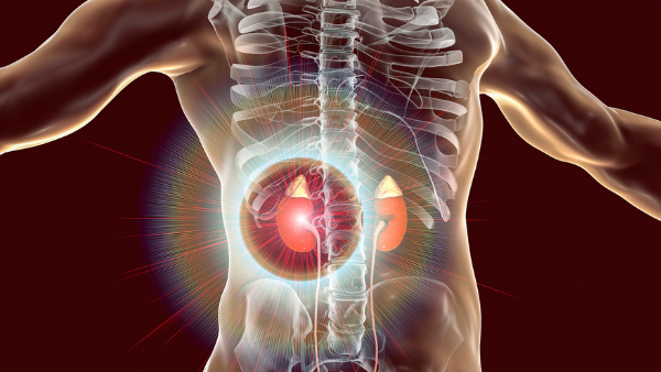 Apakah Gangguan Ginjal Menyebabkan Tekanan Darah Tinggi