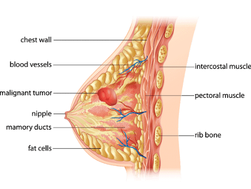 Apakah Jaringan Lemak Payudara Bisa Berkurang
