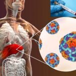 Apakah SGOT Tinggi Dapat Turun dengan Sendirinya Pada Penderita Hepatitis Akut