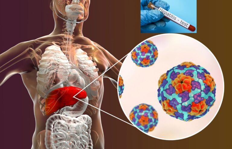 Apakah SGOT Tinggi Dapat Turun dengan Sendirinya Pada Penderita Hepatitis Akut