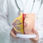 Bagaimana Bentuk Struktur dalam Payudara Sebenarnya