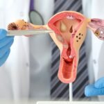 Bagaimana Cara Mengetahui Kualitas Sel Telur