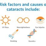 Faktor Risiko Katarak Menghindari Paparan Sinar UV dan Steroid