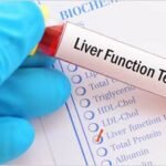 Fungsi Utama Enzim SGOT dalam Proses Metabolisme Hati