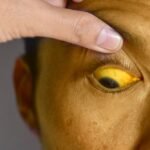 Gejala Gangguan Hati yang Sering Diabaikan, Waspada Sejak Dini!