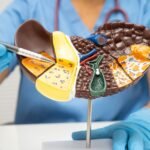 Gejala hepatitis awal