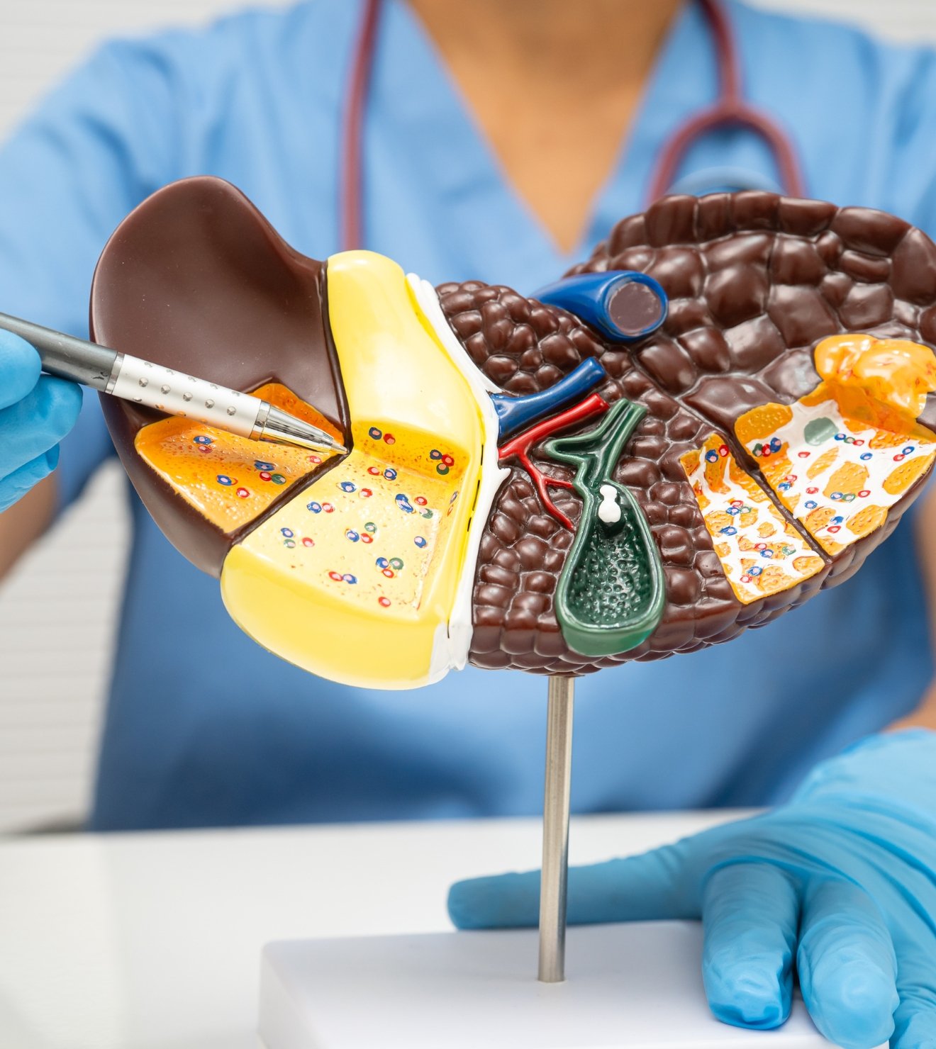 Gejala hepatitis awal