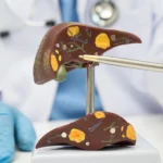 Makanan yang baik untuk kesehatan hati