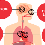 Mengapa Hipertensi Disebut sebagai Penyakit Peradangan Kronis