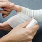 Mengapa Kulit Mudah Memar Saat Fungsi Liver Menurun