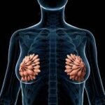 Apakah kelenjar susu mempengaruhi kekerasan payudara?