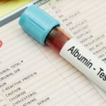 Mengenal Albumin, Protein Penting yang Diproduksi oleh Organ Hati