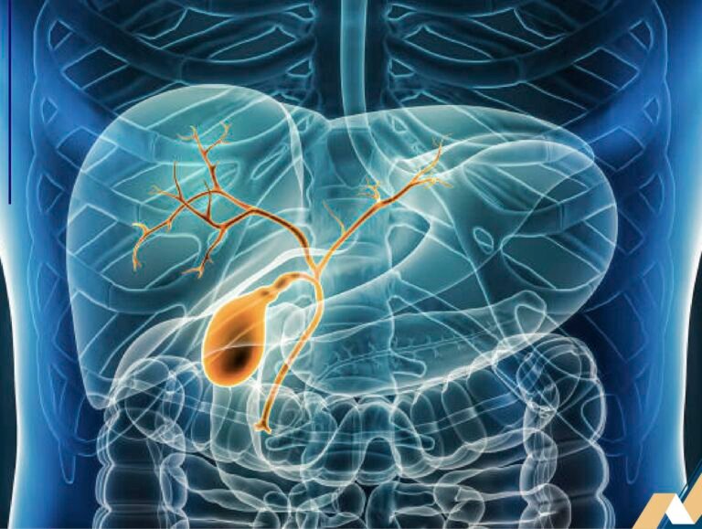 Mengenal Kolestasis, Gangguan Aliran Cairan Empedu dari Hati