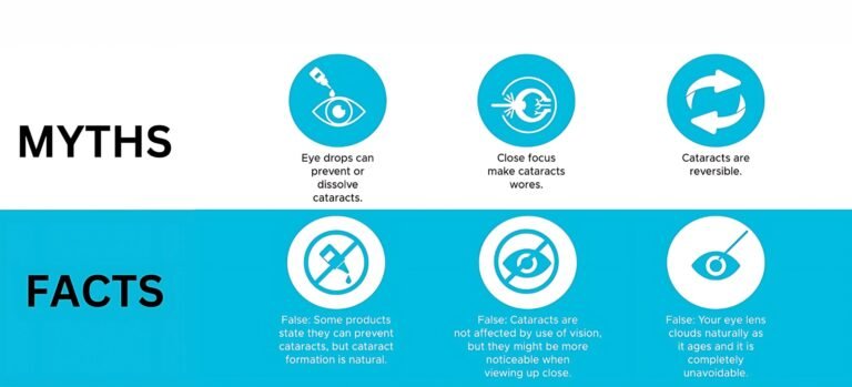 Mitos Seputar Katarak yang Perlu Diketahui