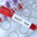 Nilai Normal SGOT pada Hasil Uji Fungsi Hati