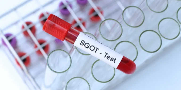 Nilai Normal SGOT pada Hasil Uji Fungsi Hati