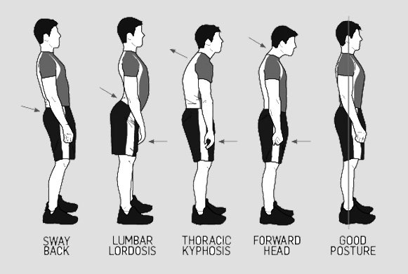 Pentingnya Menjaga Postur Tubuh untuk Penampilan yang Lebih Menarik