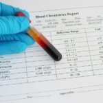 Penyebab Kadar SGOT Tinggi dalam Pemeriksaan Darah