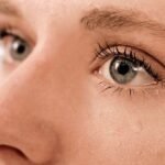 Penyebab Mata Gatal dan Berair Cara Cepat Mengobati Alergi Mata