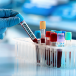 Suplemen Penambah Berat Badan yang Aman dan BPOM