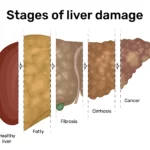 Tahapan Kerusakan Hati yang Wajib Diketahui
